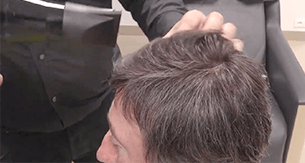 Styling the CNC hair prosthesis