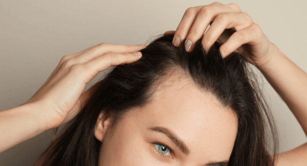 Female Hair Loss Treatment